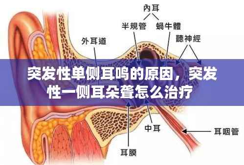 突发性单侧耳鸣的原因，突发性一侧耳朵聋怎么治疗 